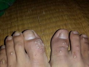 钓鱼技巧（钓鱼技巧，蚂蚁咬钩防治，钓鱼秘籍）